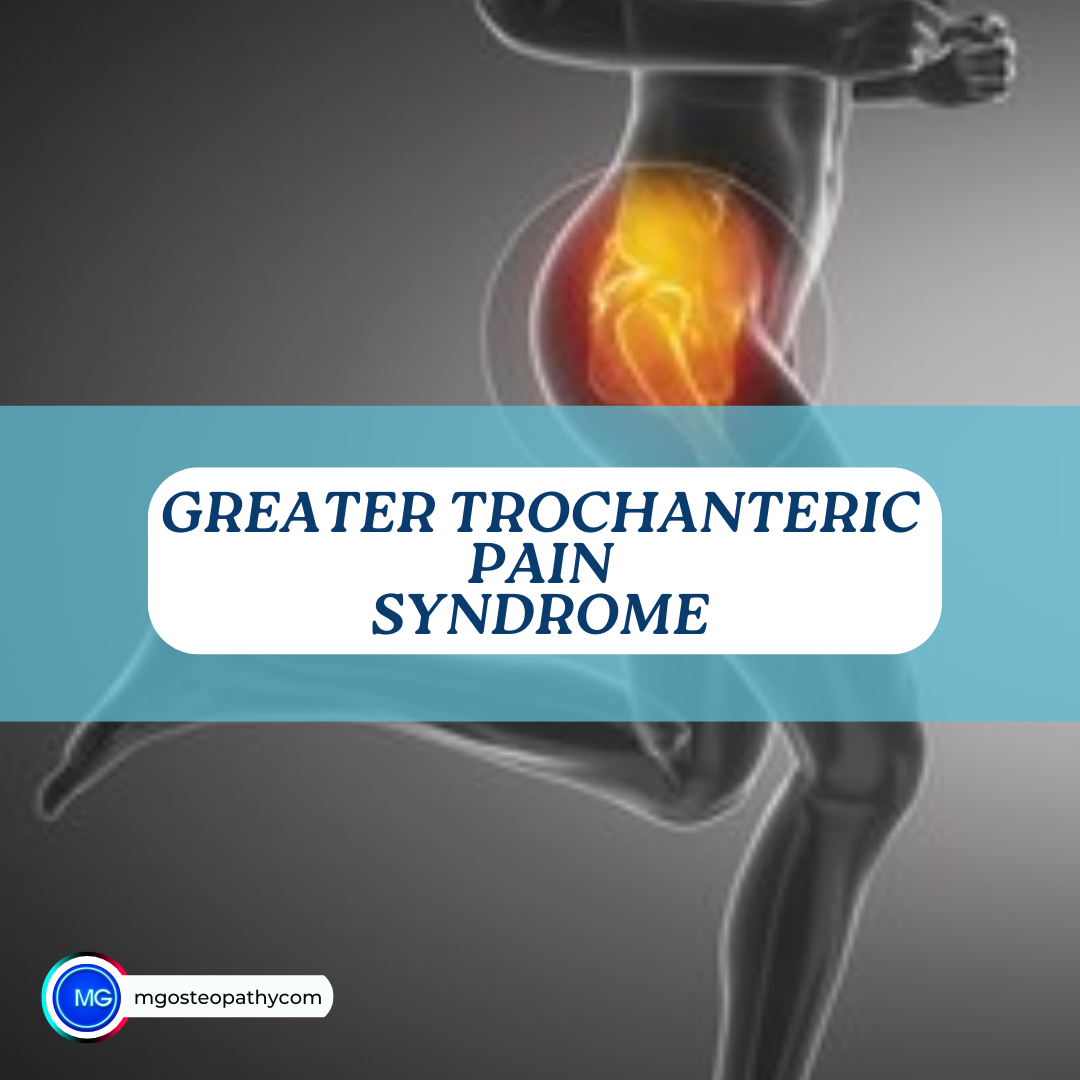 Greater trochanteric pain syndrome | MG Osteopathy & Sports Injury Clinic, Hackney, London | MG Osteopathy & Sports Injury Clinic, Hackney, London