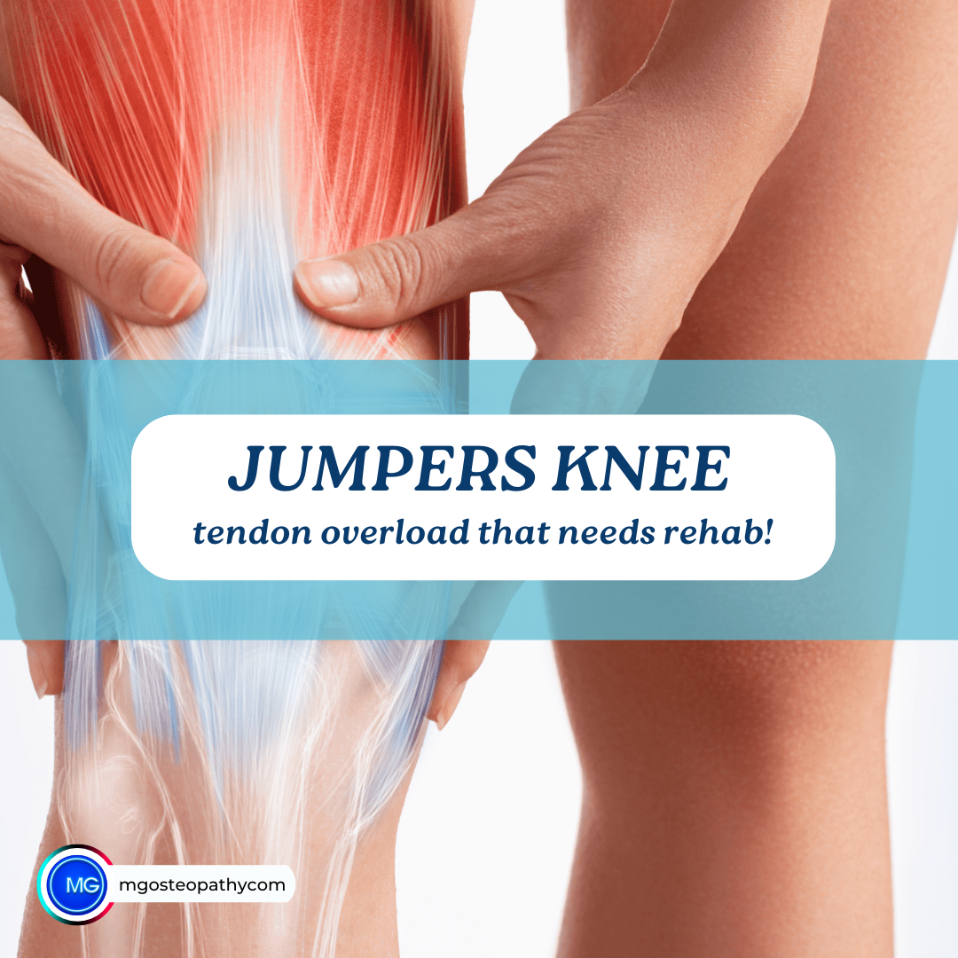 Jumpers Knee | MG Osteopathy & Sports Injury Clinic, Hackney, London | MG Osteopathy & Sports Injury Clinic, Hackney, London