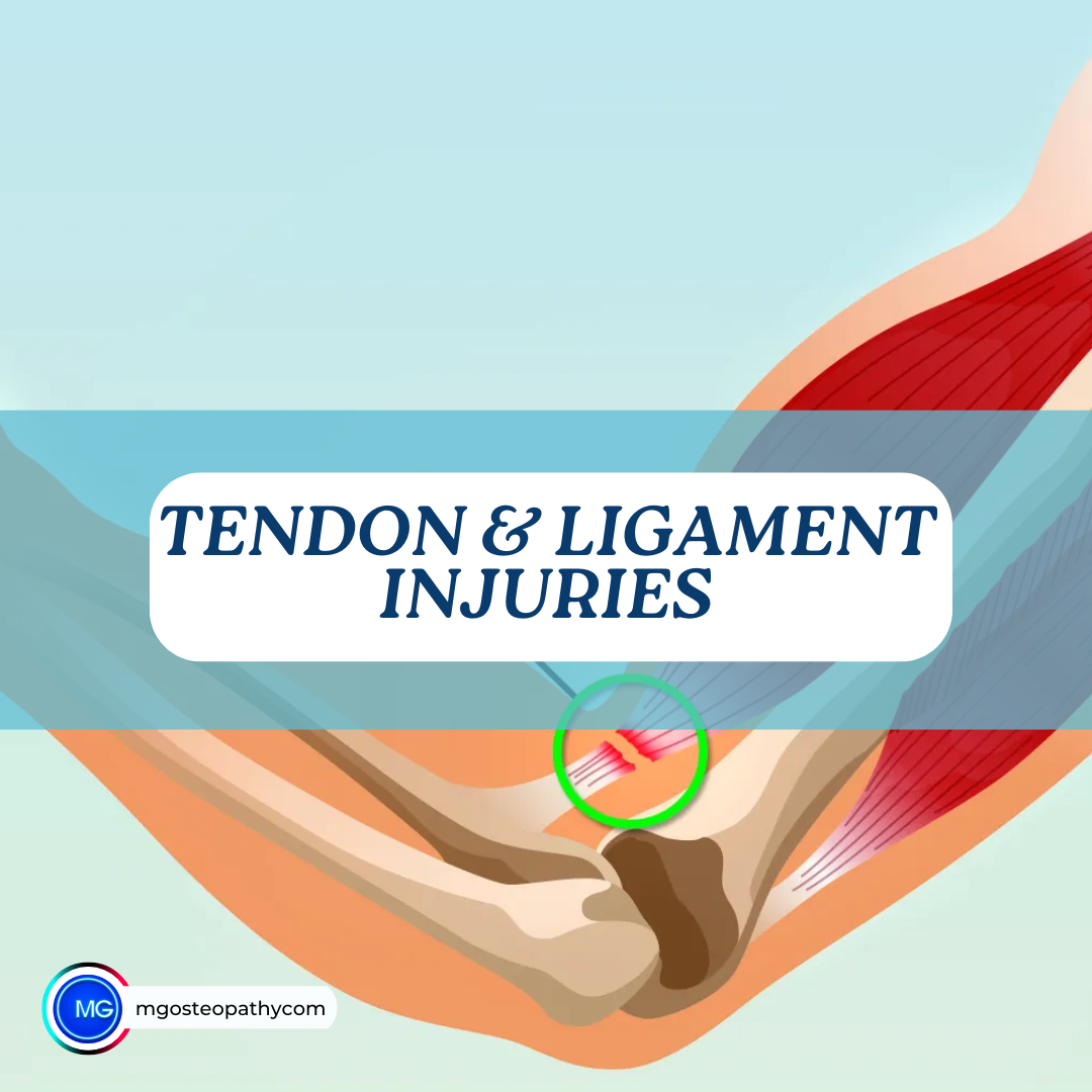 tendon & ligament injuries | MG Osteopathy & Sports Injury Clinic, Hackney, London | MG Osteopathy & Sports Injury Clinic, Hackney, London
