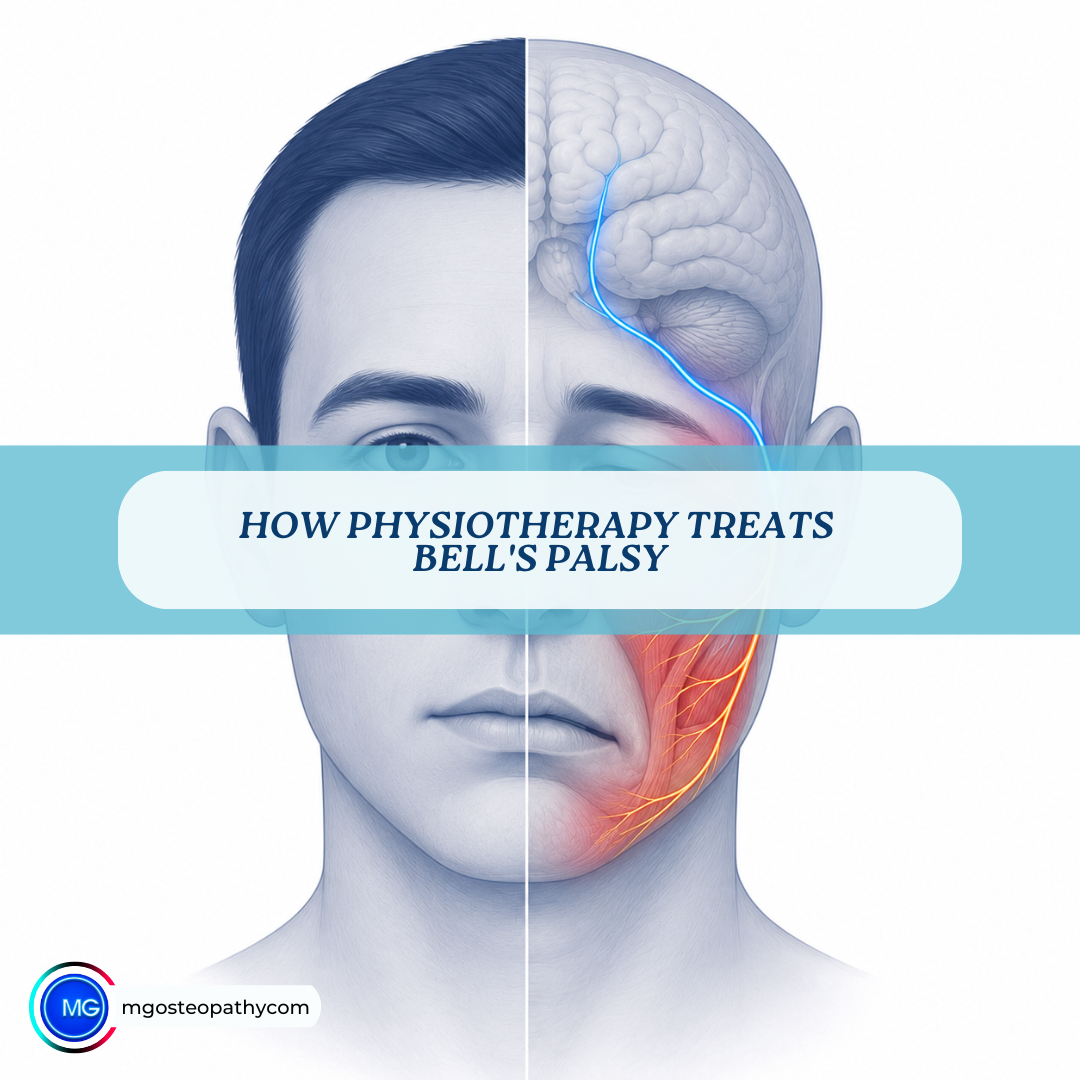 How Physiotherapy Treats Bells Palsy | MG Osteopathy & Sports Injury Clinic, Hackney, London | MG Osteopathy & Sports Injury Clinic, Hackney, London Split-face illustration: brain and facial nerve highlighted on the right, with a turquoise banner reading 'How Physiotherapy Treats Bell's Palsy' across the image.